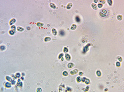 Oligoporus ptychogaster;Sporen;Obj.100xÖl.jpg