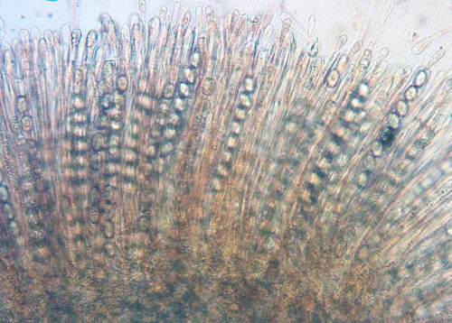 Scutellinia b.Tub.Asci;Obj.20x.jpg