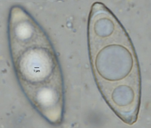 Gyromitra_ticiniana_Spore.jpg