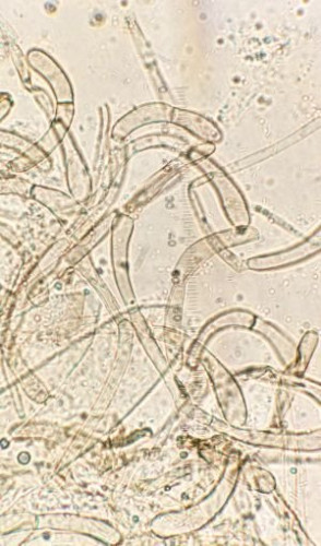 KL geoglossum spec paraphysen 3.jpg