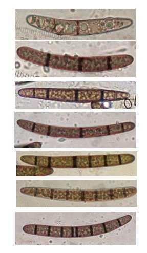 KL geoglossum spec sporen 2-8 seps 1.JPG