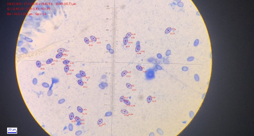 bhhgfpg5pjvignmhydazfvumh0iy4urd 00115.jpg