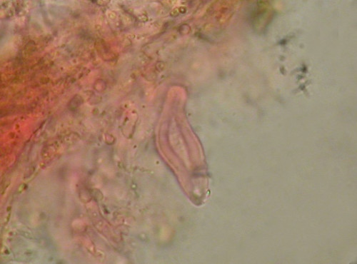 Auriporia Zystide ohne Harzkappe.jpg